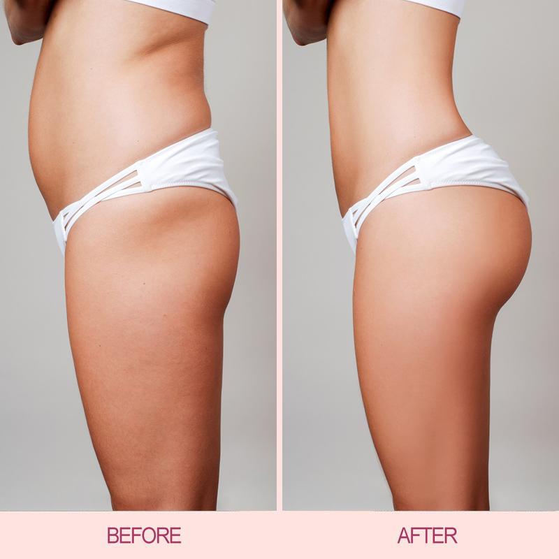 Hip Lift Up & Butt Enhancement